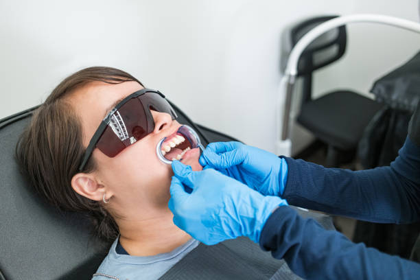 Best Knocked-Out Tooth (Avulsed Tooth) Treatment in Florence, KY